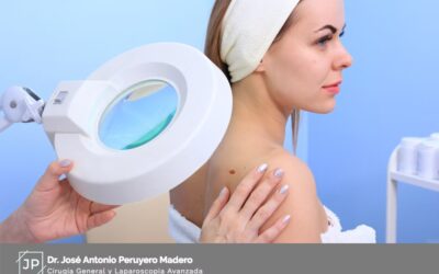 ¿Las biopsias están siempre asociadas con el cáncer?