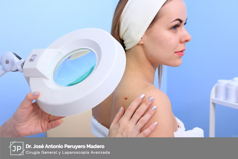 ¿Las biopsias están siempre asociadas con el cáncer?